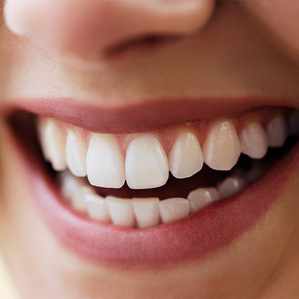Closeup of smile with metal free dental crown