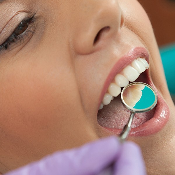 Dentist examining smile after placing tooth colored filling